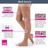medi Assure 20-30 mmHg Thigh High Compression Stockings with Silicone Top Band – Open Toe Leg Circulation, Stockings for Women, Semi-Opaque Leg Support Compression Hosiery , Small, Beige