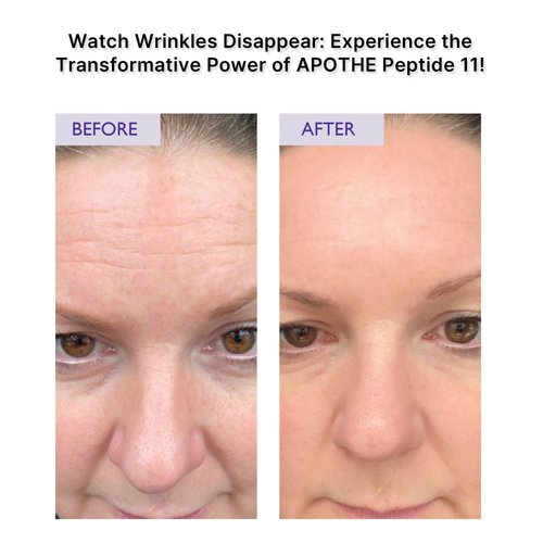APOTHE Peptide 11 Botulinum Tension Up Repair Cream 50ml(1.69 fl.oz.)