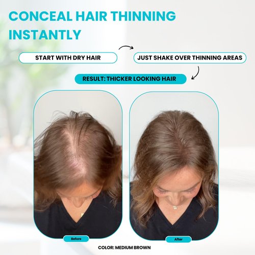 SURETHIK Hair Fibers for Thinning Hair, Building Hair Fibers to conceal thinning hair, Instantly Fuller Looking Hair for Men & Women, Medium Brown, 15g