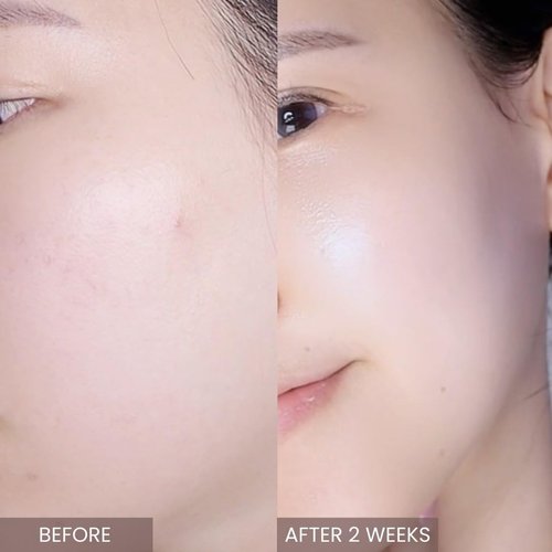 aplin Pink Tea Tree Intensive Cream - 50g/Skin Moisturizer/Facial Moisturizers/1.7 Oz, CICA, Allantoin, Korean Skin Care, Moisturizer, Hydrating