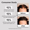Aravi Organic Hair Growth Serum With 3% Redensyl, 2% Anagain, 2% Procapil - For Hair Growth And Hair Fall Control - For Men & Women - 1 FL Oz / 30ml