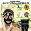 Black Deep Cleansing Face Mask, Mild, Non-Irritating, Gentle Exfoliating, Pore Minimizing, Skin Purifying, Detoxifying, Refreshing