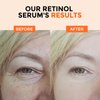 Retinol Serum for Face 2.5%, B5 Resurfacing Retinol Serum with Vitamin C, Vitamin E, Hyaluronic Acid, Niacinamide, Serum for Anti-Aging, Wrinkle Smoothing, Dark Spot Corrector, Brighten Dullness