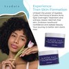 Ayadara Cystic Acne Spot Treatment, Overnight Hormonal Cystic Acne Treatment for Face, Women, Men and Teens, Cystic Hormonal Acne Treatment for Body, Pimple Cream, Sulfur Acne Spot Treatment, 120 Uses