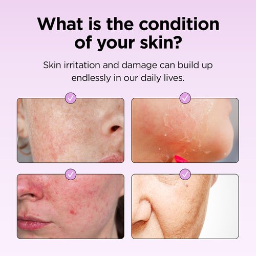 Superfood for Skin Hyalusteen Repair Toner - Facial Hydrationg Toner/Korean Skincare Soothing Toner for Face (5.07fl.oz, 150ml)