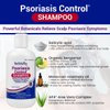TriDerma Psoriasis Control Scalp Exfoliator Shampoo 8.3 oz & Dry Scalp Moisturizing Hair Conditioner 6.0 oz, Salon Quality Dry Scalp Treatment Hair Care, Fresh Rosemary Oil, Value Bundle