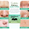 LivaClean (102 Strips Charcoal Blackhead Remover Pore Strips for Face Nose Pores - Blackheads Removal - Blackhead Removers - Blackhead Remover Strip - Black Head Nose Strips Black Head Remover