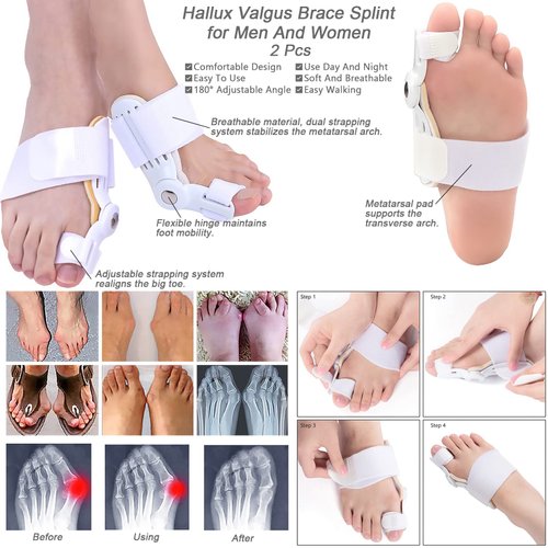 Bunion Corrector For Women Men, Bunion Pads Kit 15Pcs, Hallux Valgus Relief, Toe Spacer Straightener, Big Toe Separator Correction Splint Hammer Gel Metatarsal Sleeve Protector Brace Exercise Strap