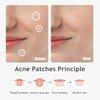 Dazzlook Ultra Pimple Patches - Hydrocolloid Acne Patch for Covering Zits and Blemishes Breakouts Spot Acne Dots Stickers for Face and Skin (120 count) 3 Size Day and Night Use