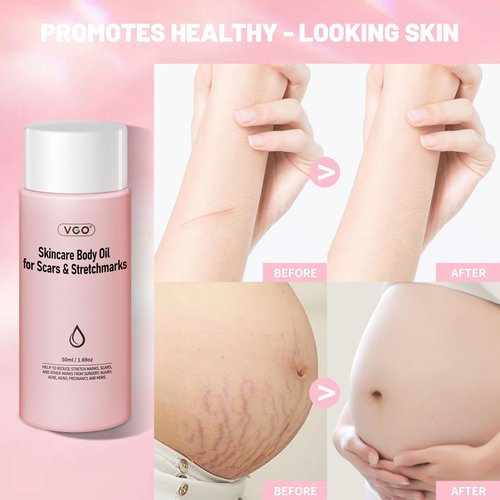 VGO Skincare Body Oil for women, Vitamin E Oil for Scars Away, Stretch Mark Oil for All Skin Types, 50ml / 1.69oz