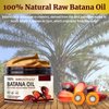 Batana Oil for Hair Growth Upgrade 100% Natural Raw and Pure Dr. Sebi Organic & Pure Unrefined Hair Oil, Hair Growth Oil Prevent Hair Loss, Restores Damaged Hair and Scalp, Prevent Hair Loss (1Pcs)