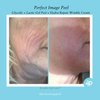Perfect Image Hydra-Repair Wrinkle Cream for Face (Post Peel), Anti Wrinkle Cream with Matrixyl 3000, Argireline, Hyaluronic Acid, and Natural Botanical Extracts