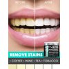 Activated Charcoal Powder Teeth Whitening - Remineralizing Tooth Powder for Tooth Whitening | Blanqueador de Dientes | All Natural Toothpaste Alternative | Sensitivity Treatments