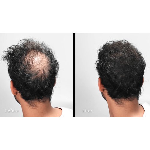 LUXE Hair Thickening Fibers for Unisex, CONFIDENCE IN A JAR, 2 Months+ Supply. Hypoallergenic, Dermatologist Tested, Multiple Colors Available (Black)