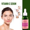 Genovie MD Vitamin C Brightening Serum For Face - Made with Anti Aging Properties, Hyaluronic Acid, Vitamin C - Facial Serum for Dark Spots, Fine Lines, Discoloration, and Wrinkles, 1 fl oz