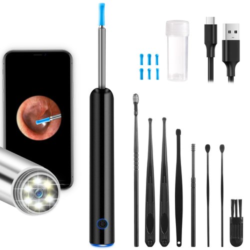 NiceBirdie Ear Wax Removal Tool, Ear Cleaner with Camera and Light 1080P Ear Scope Ear Wax Removal Tool Camera Earwax Removal Cleaning Kit Includes 2 Silicone Ear Scoops 6 LED Lights, Black (Black)