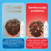 Anti-Dandruff and Anti-fungal Shampoo - Treats Folliculitis, Seborrheic Dermatitis, Psoriasis - Relieves Itchy, Dry Itchy Scalp Treatment, For Normal to Oily Scalp Prone to Folliculitis, 8.4 fl. oz 1