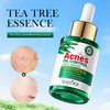 Tea Tree Oil for Face - Acne Serum - Unclog Pores, Soothe Breakouts - Blemish Spot Treatment for Smooth, Glowing Skin - Tea Tree Oil for Skin, 1.1 Fl Oz