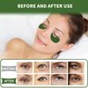 Qyiywim Under Eye Patches 70PCS, Green Tea Eye Patches for Puffy Eyes Treatment, Under Eye Masks for Dark Circles and Puffiness, Non-Irritating Eye Mask Skincare, Eye Gel Pads, Eyes Bags Treatment