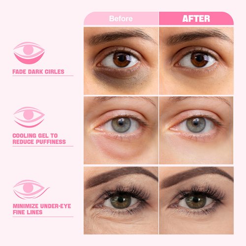 ZealSea Under Eye Patches for Puffy Eyes and Dark Circles (Collagen, 20pairs), Anti-wrinkle Patches, Eye Bags Remover for Women, Eye Masks-Pads-Gels for Spa Party Christmas Gifts, Vegan Cruelty-Free