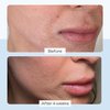 First Aid Beauty Ultra Repair Cream Intense Hydration Moisturizer for Face and Body - 8 oz.