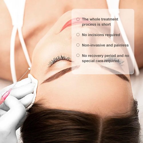 Oldream Pdo Threads 30G13mm,Pdo Threads for Face Lift,Pdo Screw Threads,Pdo,Thread Face Lift,Thread Pdo,20Pcs