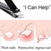 Liangery Nail Clippers Professional Nail Cutter for Ingrown Toenail Removal Treatment Tools, Fingernail Nippers with Comfort Grip Handle Slanted Cuticle Trimmer for Men Women Seniors Adult Thick Nails
