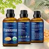 Organic Frankincense Essential Oil 30 ml - Boswellia Serrata - Natural, Pure Frankincense Oil for Diffuser, Aromatherapy - Therapeutic Grade - Skin Use and Hair Care Benefits from Nexon Botanics