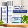 Itch Cream for Itchy Skin Relief - Moisturizing Cream & Face Lotion for Women - Redness Relief for Face & Body Cream - Hydrating Face Cream for Dry Skin & Itchy Scalp Relief - Anti Itch Lotion (4oz)