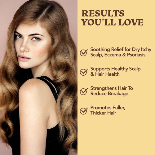 Eczema & Psoriasis Shampoo & Conditioner Set For Men & Women - Aloe Vera & Manuka Honey for Gentle Itchy & Dry Scalp Treatment - Anti-Dandruff, Anti-Seborrheic Dermatitis, Sulfate Free, Hypoallergenic