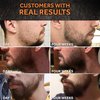 Beard Growth Oil - 1Fl Oz - Growing Serum That Softens & Strengthens Beards and Mustaches - Facial Hair Treatment Treatment Infused with Biotin Capilia Longa Niacinamide and 100% Natural Ingredients