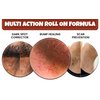 Dark Spot Corrector for Body & Ingrown Hair Treatment | Folliculitis Treatment | Razor Bumps and Ingrown Hair Treatment | Dark Spot Treatment Roll On for Men & Women