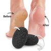 SALVMARY Natural Pumice Stone for Feet - Lava Foot Scrubber Dead Skin Corn Callus Remover Exfoliator Pedicure Tools for Feet Heels and Hands 2 Pack