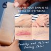 Advanced Silicone Scar Sheets Tape - Medical Grade Soft Silicone Gel Scar Sheets Tape, Highly Comfortable Painless for C-Section, Stretch Marks, Acne, Surgery, Effective Scars Treatment Tapes