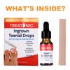 Treatonic Ingrown Toenail Treatment - Ingrown Toenail Pain Reliever and Softener Kit for Easy Trimming with Silicone Gel Toe Caps