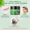 ZIIDII Raw Batana Oil for Hair Growth 100% Natural Raw and Pure Unrefined Batana Oil Dr. Sebi Organic Hair Oil,Prevent Hair Loss,Restores Damaged Hair and Scalp,Moisturize Scalp 4.05 OZ