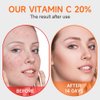 Vitamin c face serum with hyaluronic acid and vitamin e,Skin care, Anti ageing,Anti wrinkles, Smoother and Plumper Skin beauty products 1.35 fl oz