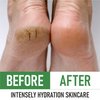 PurOrganica Urea 40% Foot Cream - Made in USA - Callus Remover - Moisturizes & Rehydrates Thick, Cracked, Rough, Dead & Dry Skin - For Feet, Elbows and Hands - With Pumice Stone and Brush