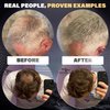 REJUVENATE Hair Fibers for Thinning Hair (Black), Undetectable Hair Powder for Men & 100% Natural Hair Building Fibers - Conceals Hair Loss - Bald Spot Cover Up Hair Powder, 2 Month Supply