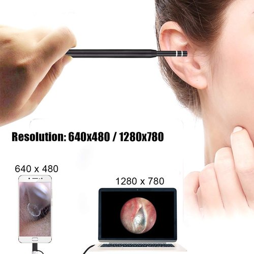 Ear Wax Removal - 3 in1 USB Earwax Removal Tool HD Ear Cleaner Endoscope with 6 LED Light, Earwax Remover Tool, Visual Ear Camera Ear Pick Cleaning Kit for Adults Kids Pets by Android Smart Phones