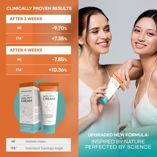 Natural Vine Dark Spot Corrector: Dark Spot Remover for Face Body in 4-8 Weeks - Instant Concealing & Age Brown Sun Faded Spot Remover Melasma Freckles Correcting with Niacinamide for Women & Men 60g