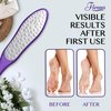 Fivona Foot File - Callus Remover for Feet, Double Sided Foot Rasp for Dry Heels, Feet Scrubber for Dead Skin, Corn Removal for Feet, Foot Scraper