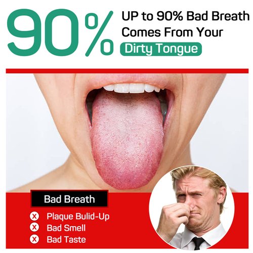 Tongue Scraper (2 Pack), Tongue Cleaner Cure Bad Breath, Tongue Cleaners Stainless Steel, Metal Tongue Scrapers for Adults Fresher Breath in Seconds.by RONAVO