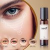 2PCS Zendi Eye Roller,Rollerball Oil and Frankincense, Oil and Frankincense Eye Roller, For Eyes, Bags Under Eyes, Wrinkles