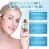 Eye Treatment Serum, Chalazion & Blepharitis Remover With Avocado Oil, Buckthorn Oil For Eyelid, 30ML Tea Tree Oil & Caffeine Eye Serum For Redness, Puffiness, Eye Relief.