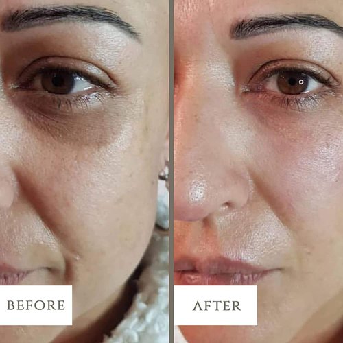 LuxeBiotics Dark Circle, Eye Bag Anti-Wrinkle Nourishing Eye Cream