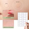 WQJifv Acne Patch Pimple Patch, 2 Size 288 Patches Acne Absorbing Cover Patch with Acne Needle, Hydrocolloid Invisible Acne Patches For Face Zit Patch Acne, Acne Spot Healing Patch Zit Patches