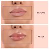 Dermaclara Claralips Collagen Infused Lip Serum- Natural & Vitamin Enriched Hydrating Lip Gloss - Hydrate and Moisture Lip Care Serum for Beautiful Fuller Lips - Help Reduce Dryness and Wrinkle Lines