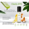 Clearly ZITS Natural Acne Spot Treatment for Face | Dries and Conceals | Fast Results with Tea Tree and Aloe Vera | Mild, Moderate, Hormonal, Teen, Severe Cystic Acne | Made in USA