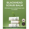 OBgE Blackhead Scrub Balm (0.7oz) - Moisturizing Scrub Stick for Blackhead Removal, Pore Minimizing, Gentle Exfoliation & Moisturization. Tea Tree, Green Tea & Heartleaf.